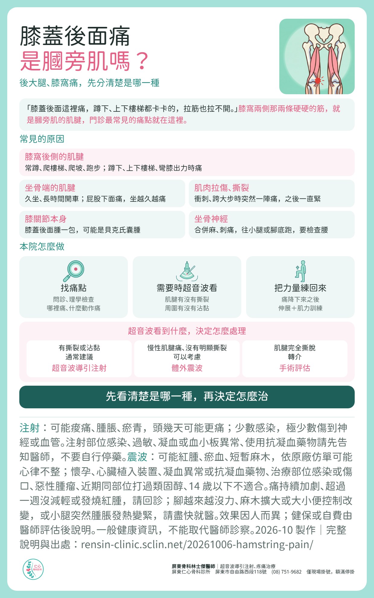 膝蓋後面痛是膕旁肌嗎？膝窩兩側那兩條硬硬的筋就是膕旁肌的肌腱，門診最常見的痛點在這裡。常見原因：膝窩後側的肌腱、坐骨端的肌腱、肌肉拉傷撕裂、膝關節本身（貝克氏囊腫）、坐骨神經。本院怎麼做：問診與理學檢查找痛點、需要時超音波看肌腱有沒有撕裂與沾黏、痛降下來之後伸展與肌力訓練。有撕裂或沾黏通常建議超音波導引注射；慢性肌腱痛、沒有明顯撕裂可以考慮體外震波；肌腱完全撕脫轉介手術評估。先看清楚是哪一種，再決定怎麼治。